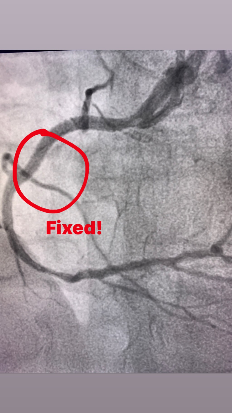 Illustration for article titled Cardiac Catheterization - it’s been a fun two days